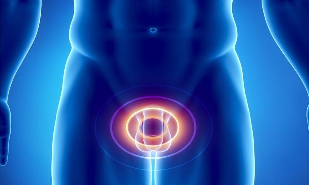 Inflammation of the prostate with prostatitis