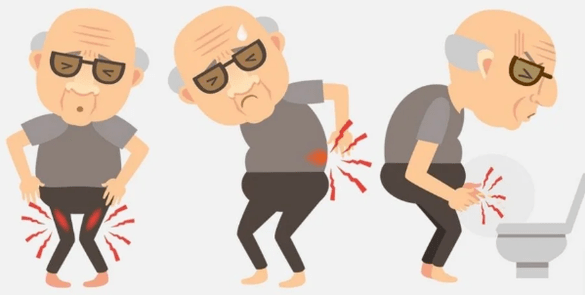 Prostatitis symptoms